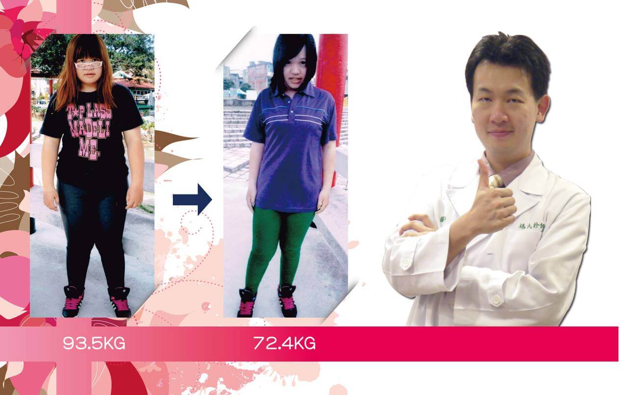 鄭源醫師讓我重拾女孩的笑容